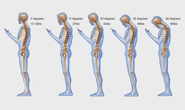 Constant-texting-is-hurting-your-spine-badly