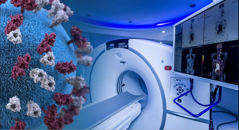 Radiation-Therapy-Treatment-COVID19-TechJuice